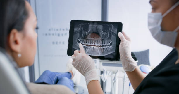 Licensed Tooth Extraction service in Burbank, CA - Smile Center Dentistry